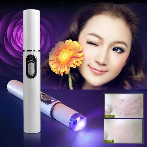 Blue Light Therapy Acne Laser Pen for Scar & Wrinkle Removal